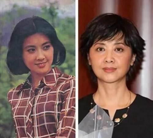 二十几岁法令纹特别明显是为什么,为什么比同龄人法令纹特别重