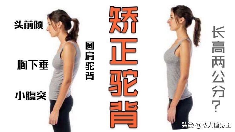 你有什么方法能改善驼背,如果你有驼背现象该怎么办