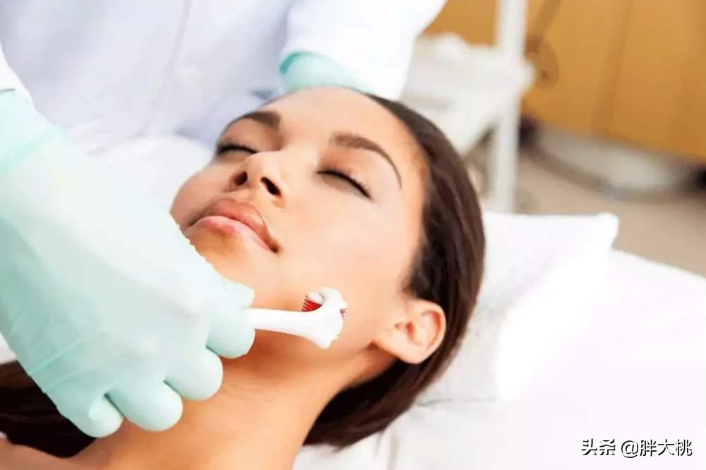 皮肤长黑头闭口刷酸真的可以吗,黑头刷酸有用吗能收缩毛孔吗