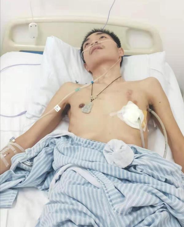 一个痛苦的尘肺病患者,尘肺不能呼吸的疼痛