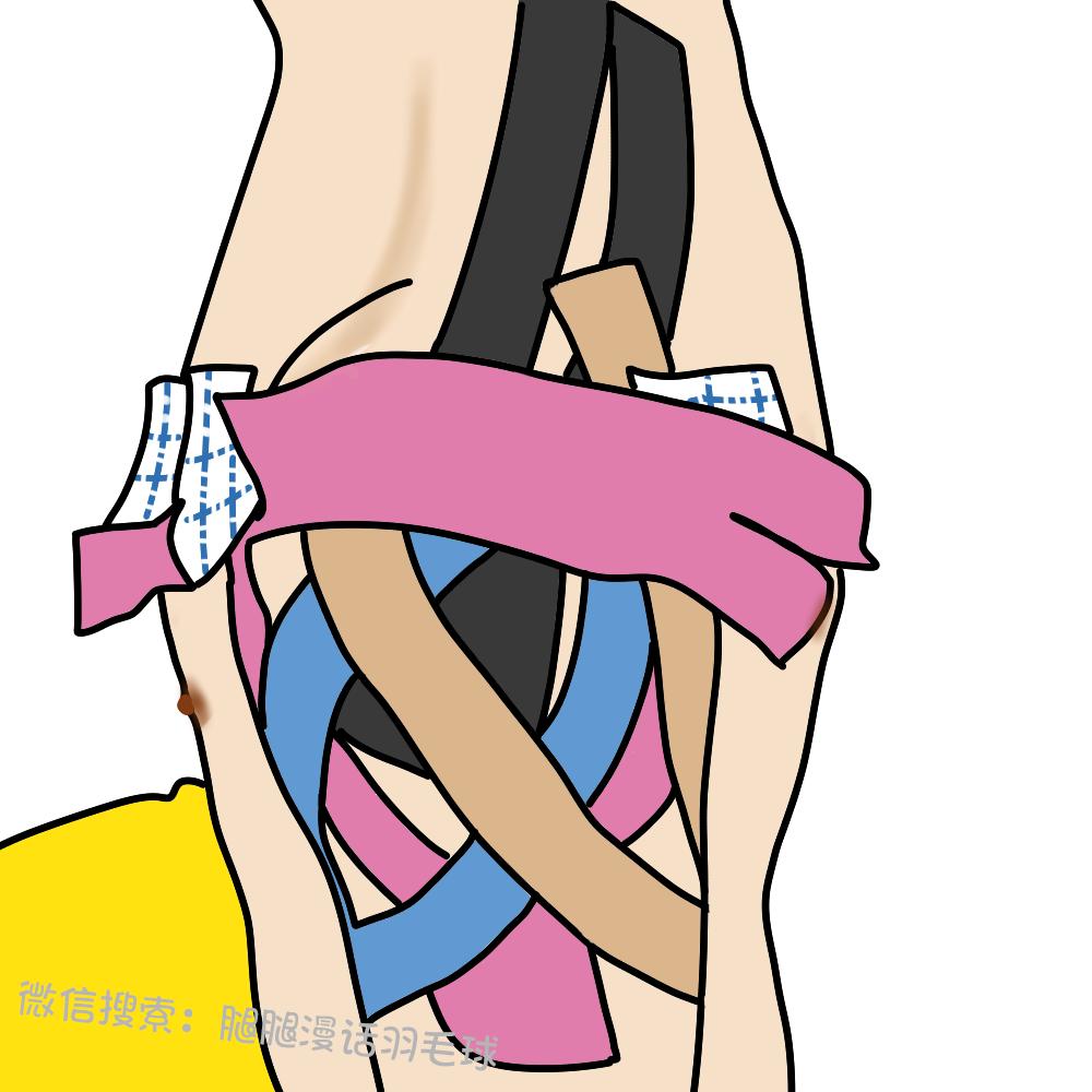 打球后肩膀痛怎么缓解,打球肩膀疼一招搞定