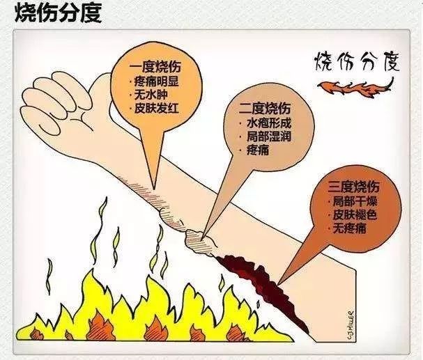 小宝宝被低温烫伤怎么办,新生儿被烫伤红肿起小泡