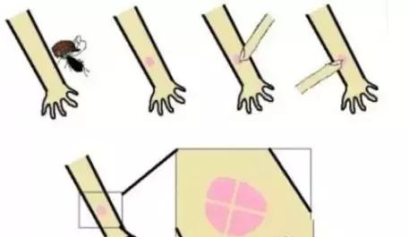 脸被打了两拳会有事吗,脸上被人用拳头打了会是怎样