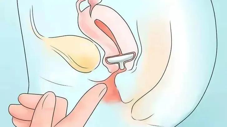 八旬老人下半身掉出一块肉，多种疾病缠身不能手术怎么办？