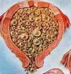 孕妇在葡萄架子下呆着不好吗,孕妇坐葡萄树下不好吗