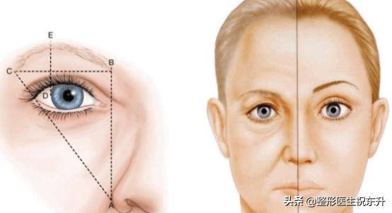 做完提眉术后如何才能不留疤痕,提眉术疤痕明显