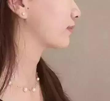 你知道什么是玻尿酸吗,如何快速了解玻尿酸品类