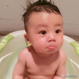 宝宝长舅舅屎的前兆,宝宝头上的舅舅屎每个宝宝都有吗