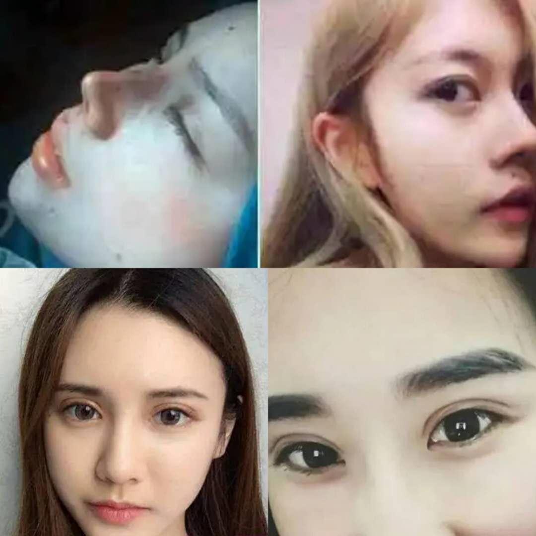 怎么样辨别自己有混血基因,混血面部分析