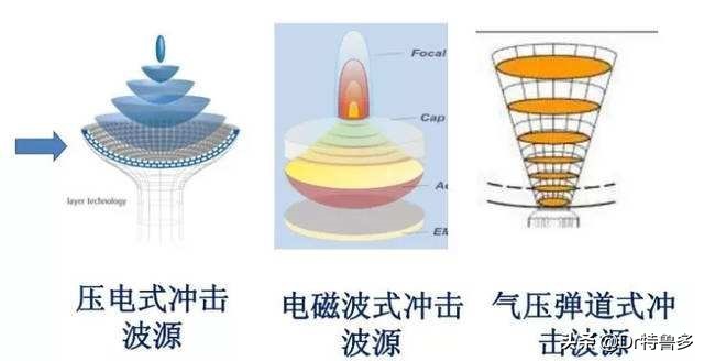 骨折了不长、长得慢怎么办？试试冲击波治疗吧