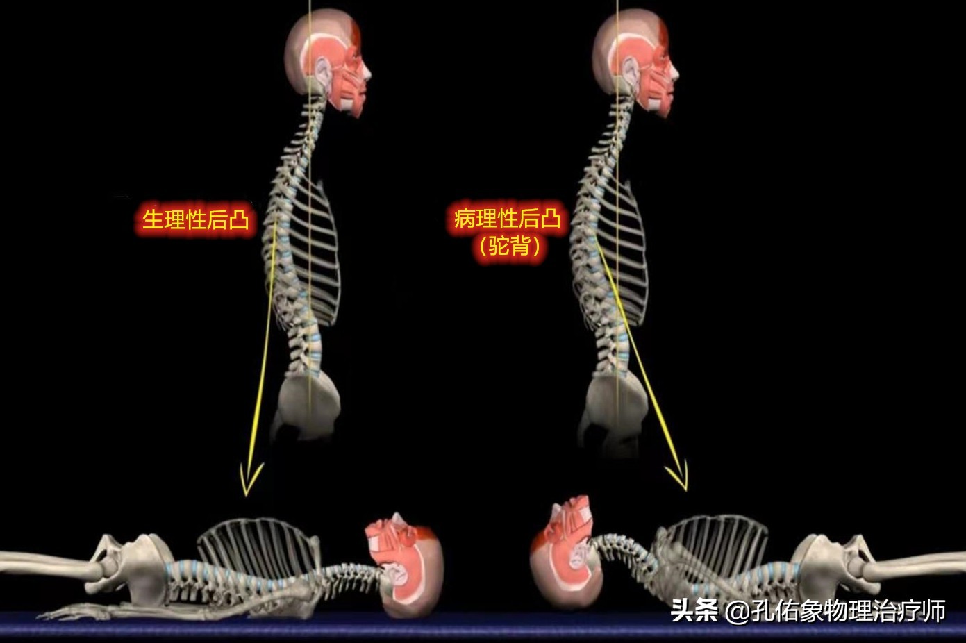 为什么弯腰之后就起不来,为什么弯腰起来特别不舒服