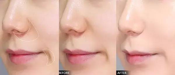 嘴凸的女生其实也很好看,凸嘴女生怎么微笑好看