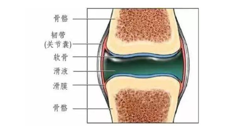 滑膜炎需要治疗吗能自愈吗,滑膜炎怎么治才能彻底治好