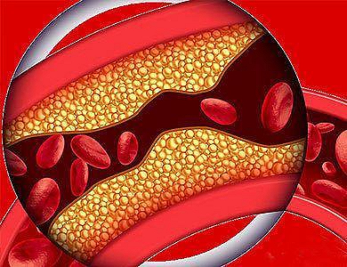 有糖尿病的人心脏痛是什么原因,糖尿病人有时胸口痛吗