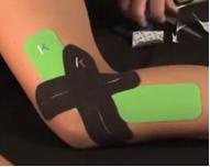 如何跑步才能避免髂胫束综合征,膝盖外侧髂胫束疼痛跑步怎么保护