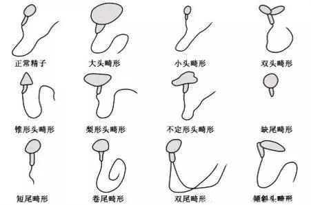 如何赢在起跑线上：精液报告教您看