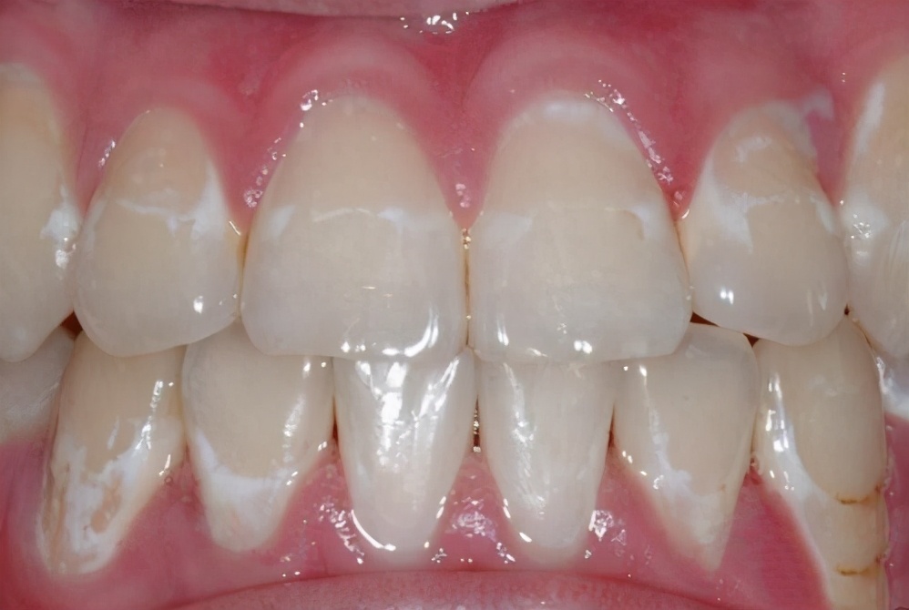 治疗牙病有哪些方法,治疗牙病一般医院都能治疗吗