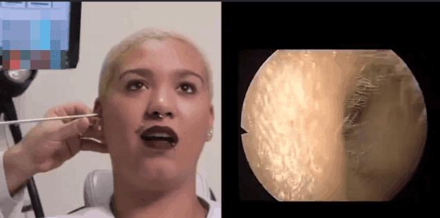 500万像素高清成像，隐秘耳道一览无遗，挖耳朵也能科技感爆棚