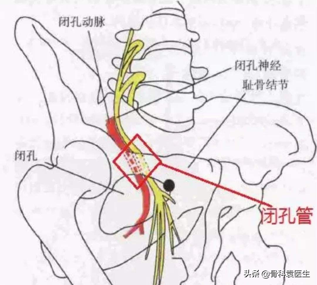 膝关节疼痛是哪个内脏出了问题,膝关节痛哪里肌肉有问题