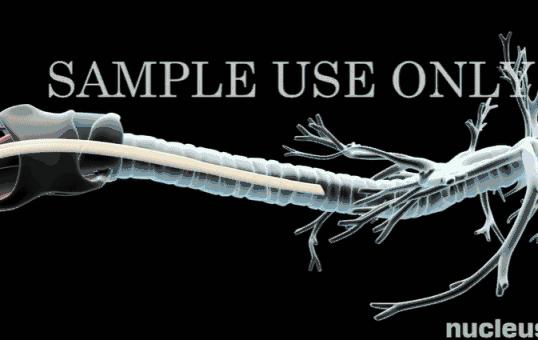 新冠肺炎重症用的机器,机械的力量