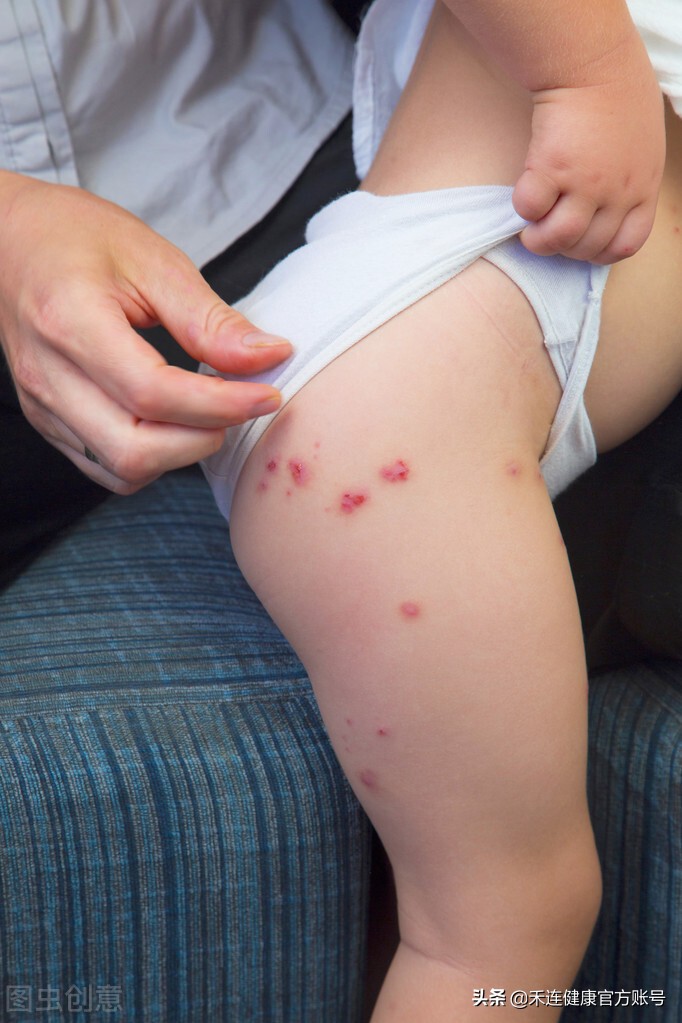 身上长小红点是肝不好吗,肝出什么问题身上会有小红点