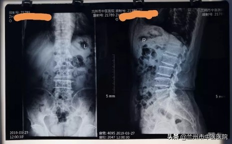 膝痛中医辨证,膝风湿关节痛的治疗方法