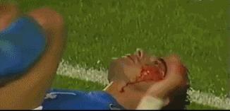 史上最让人震惊的足球比赛,足球看似实力悬殊的比赛却爆冷