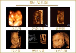 四维彩超胎儿在微笑,怀孕5个月四维检查唇裂