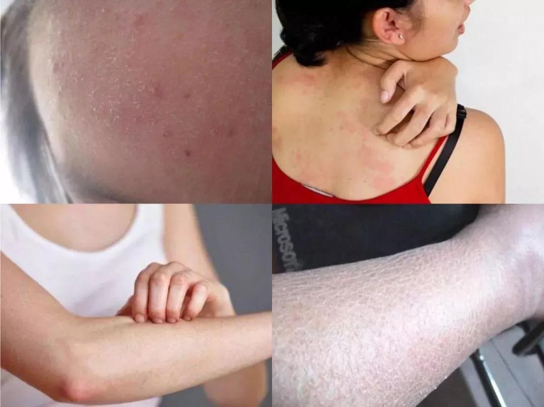 花钱买一堆护肤品不如做一次医美,重金买精华有用吗