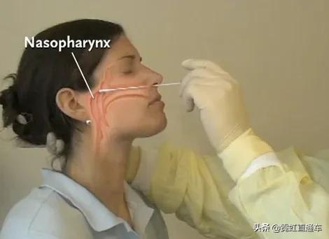 日本进口新冠自测试剂盒,以前的新冠试剂盒现在还能用吗