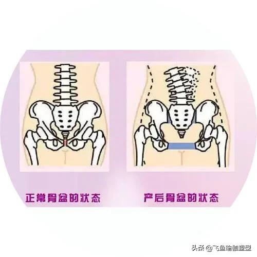 产后腰痛如何有效恢复