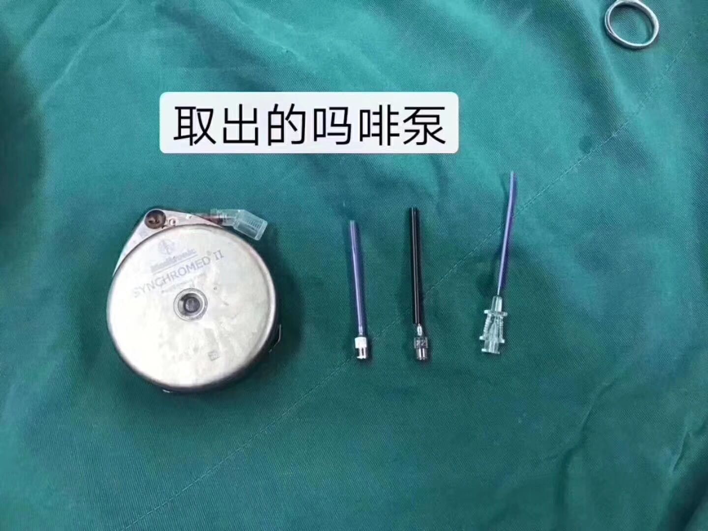 西北首例！鞘内*啡吗**泵更换术，跟疼痛说拜拜