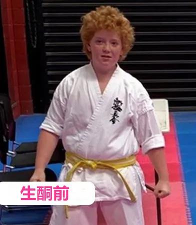 男性癫痫减肥的最佳方法,生酮治疗癫痫