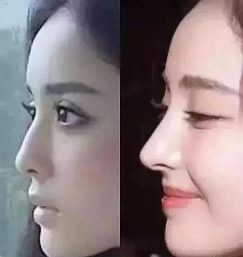 盘点一些有问题的鼻子,明星都没整好的鼻子