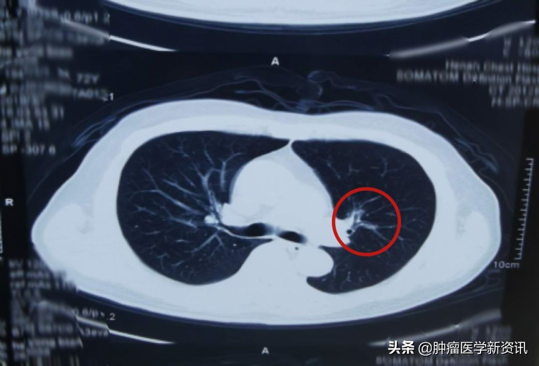 抗癌物质能治愈癌症吗,抗癌成功的几率有多大