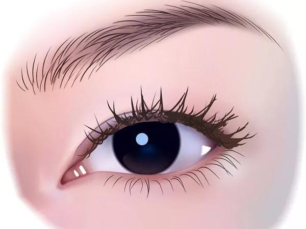 眼睛肿要注意什么,眼睛出现什么情况要注意