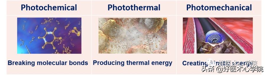 安贞医院冠心病介入治疗新技术,冠心病介入术