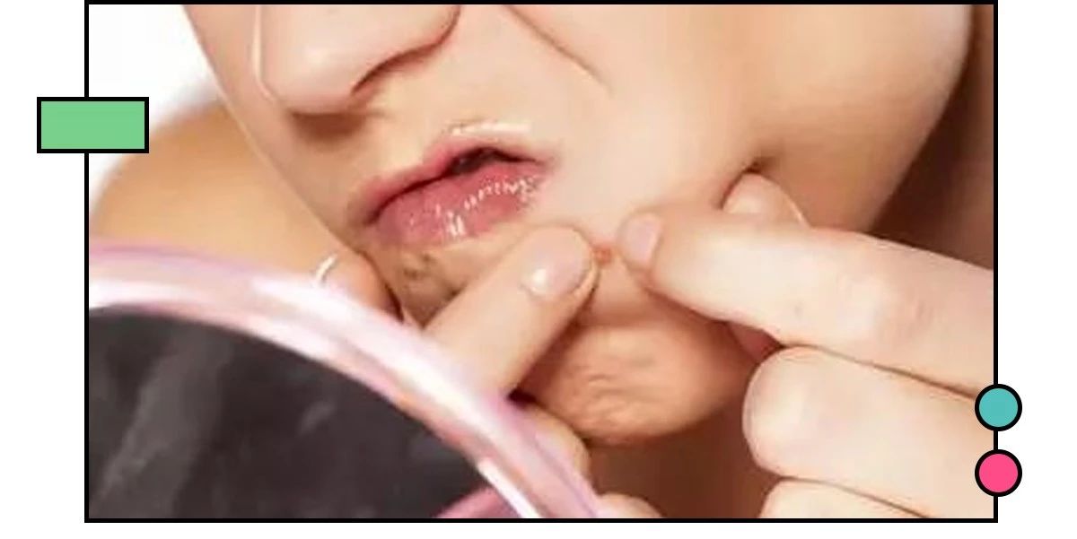 十大公认祛痘印效果最好的方法,教你几招祛痘印的最快方法