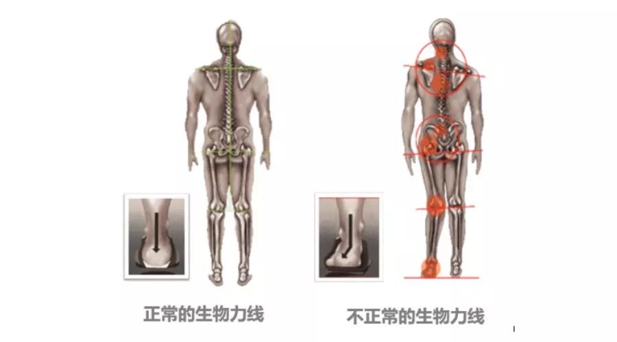 权健事件丁香园天价鞋垫被曝光,丁香园权健文章