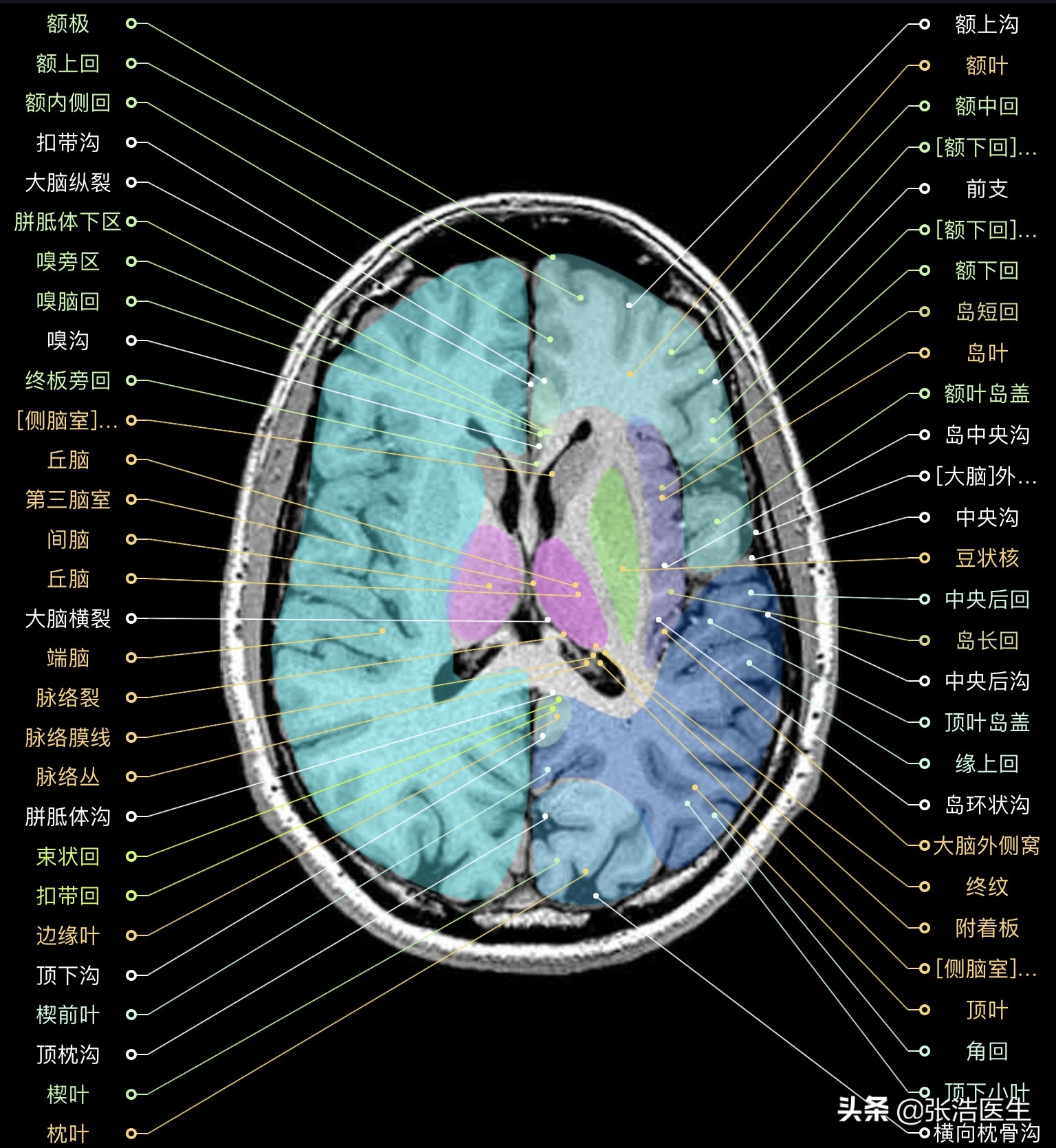 颅脑mri解剖影像检查是什么意思,颅脑mri断层解剖视频课件