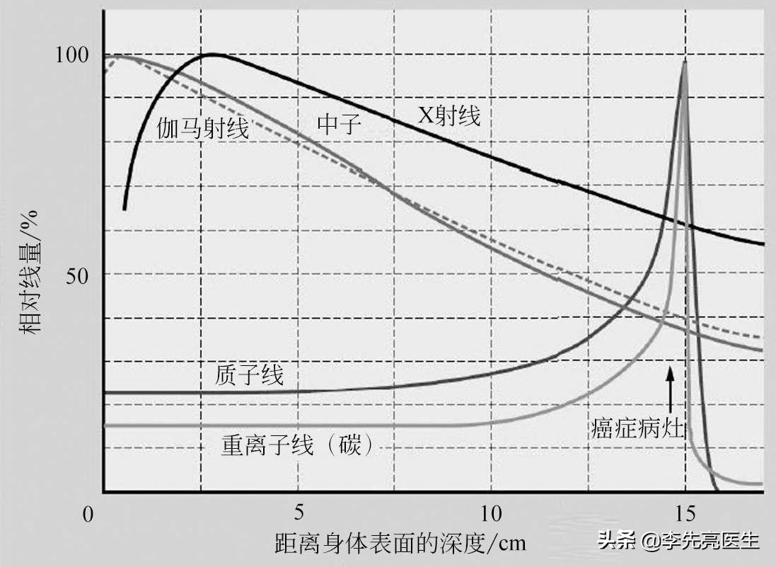 治疗癌症的质子仪,治癌新利器