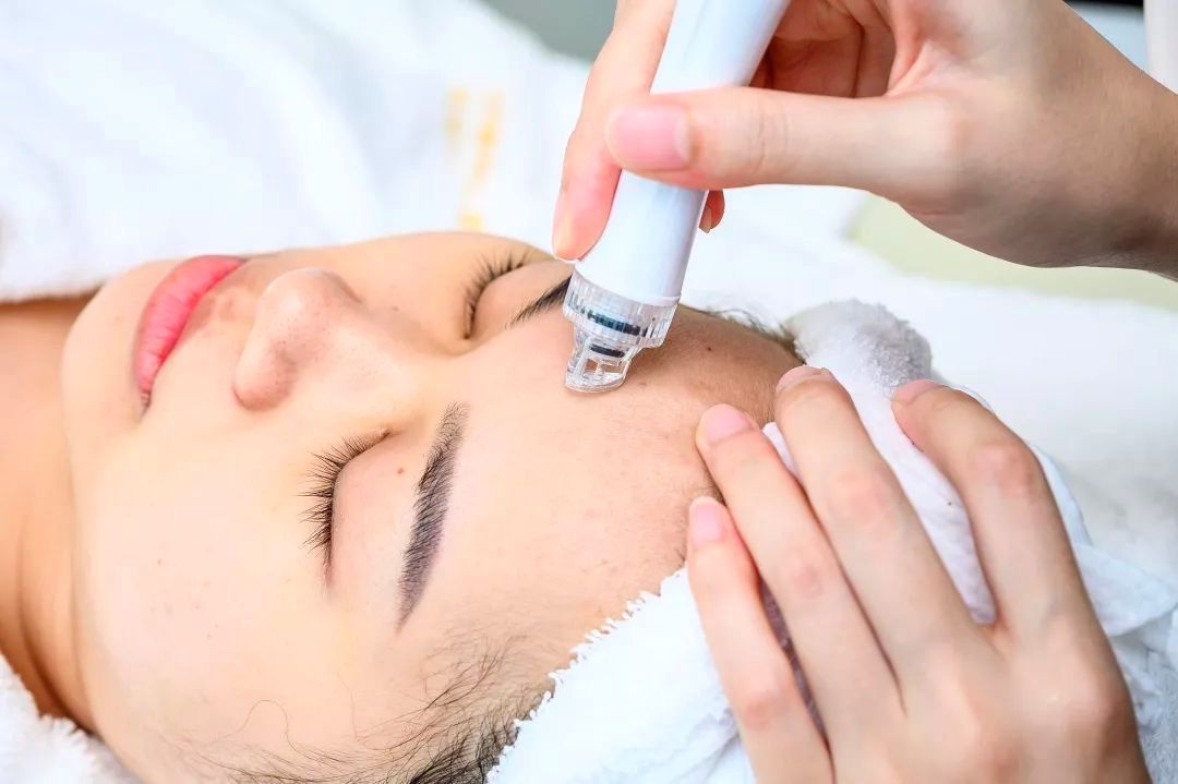 怎么去黑头最有效最方便的方法,怎样去黑头才是最有效的