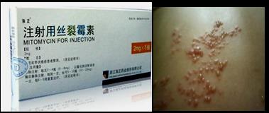 抗肿瘤药，直接影响DNA结构和功能的药物