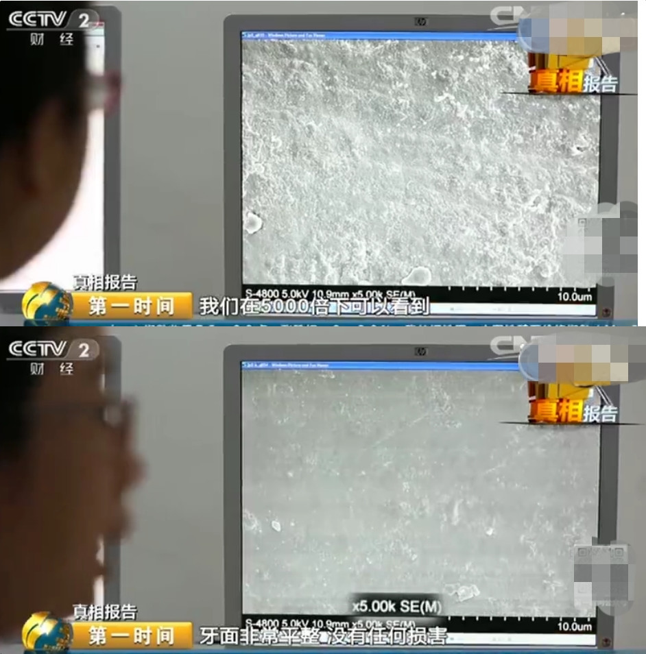 洗牙会伤害牙齿科普,洗牙会破坏牙保护膜么