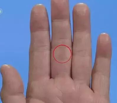 10种常见病对照表,100种常见病诊断