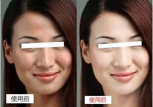 美白祛黄提亮肤色精华推荐李佳琦,李佳琦美白淡斑面膜去黄提亮肤色