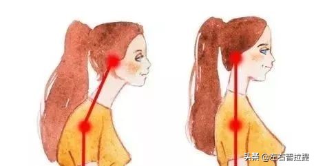 泰勒探颈毁气质?杨幂驼背变猥琐?教你1招轻松变美