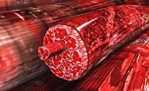 神经根型颈椎病重要特征,颈椎病各类型占比