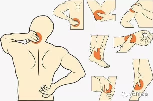 肌筋膜疼痛讲的是什么,最全肌筋膜触发点图解