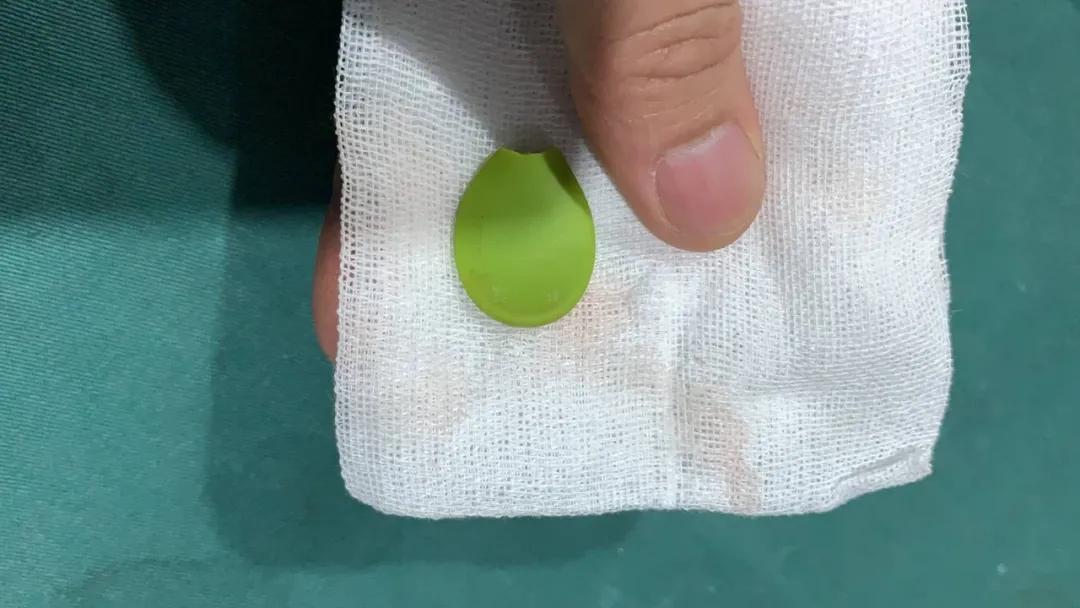 “我居然从猫屁股拽出了一根针！太可怕了！”